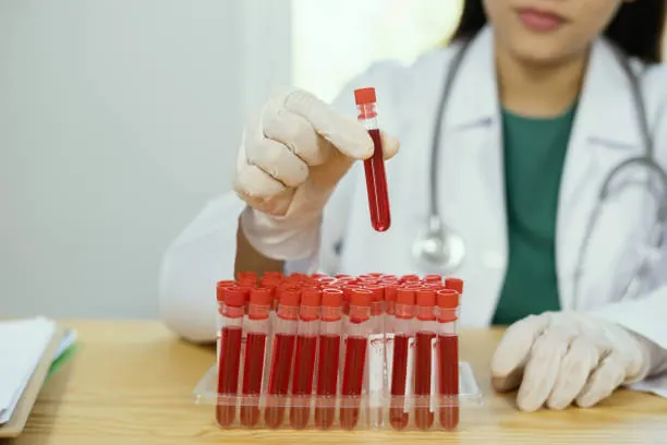 Presencia de sangre en la orina 2024